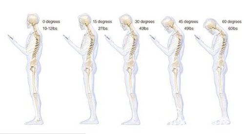 「低头族」警告!颈椎承受的巨大重量你难以估