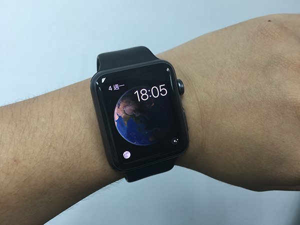apple-watch-causes-skin-rashes-for-some-users_00