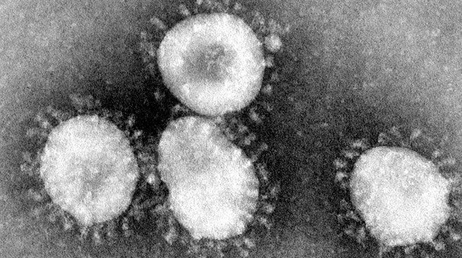 34288 61631 coronavirus l 1 1 1 1 1 1