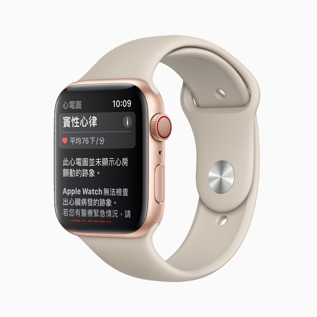 Apple watch result sinusrhythm screen 12082020 inline 1.jpg.large 1