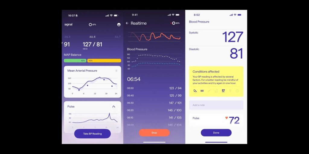 Signal Ring Gives Blood Pressure Readings
